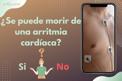 ¿Se puede morir de una arritmia cardíaca?